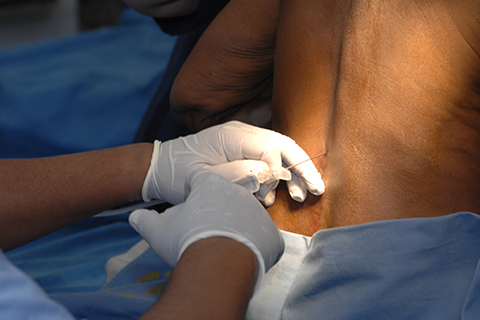 최소침습에 관한 사진